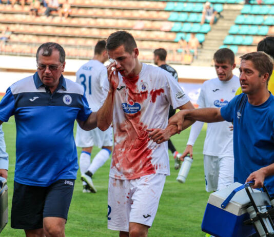 Кровавый след поражения «Динамо»